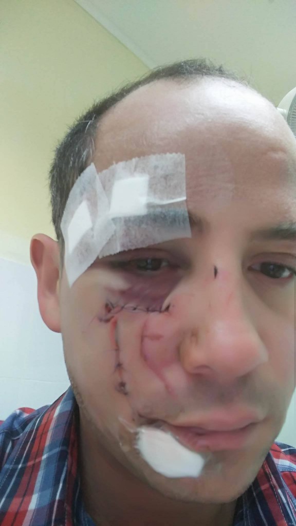 agresion1