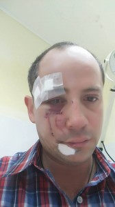 agresion2