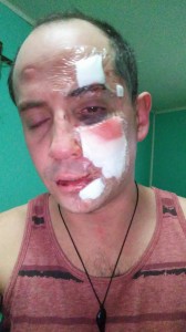 agresion3