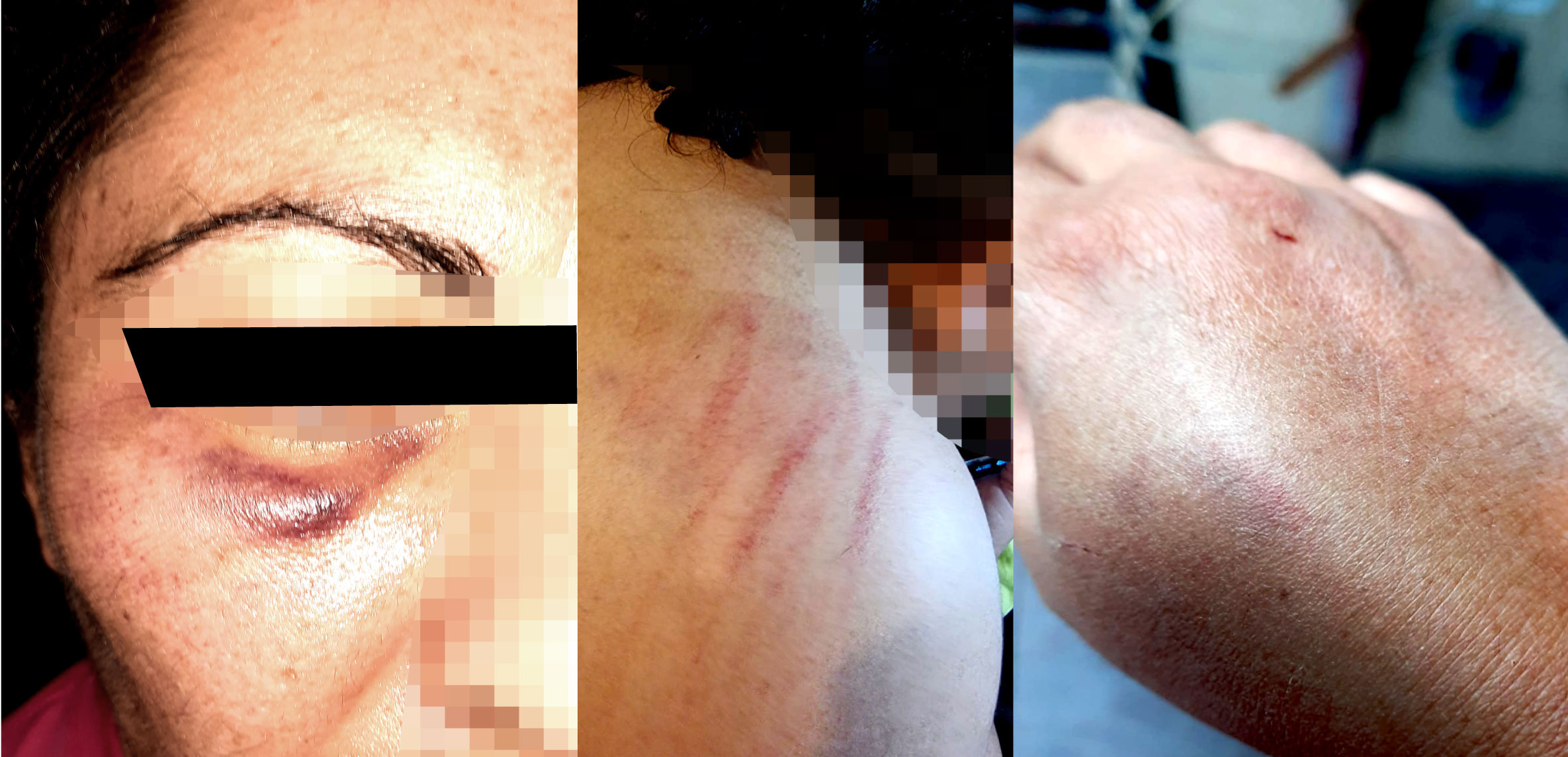 Atacan a pareja lésbica y a sus mascotas con golpes de pies, puños y palos: «mariconas, tortilleras» – Movilh Chile Atacan a pareja lésbica y a sus mascotas con golpes de pies, puños y palos: «mariconas, tortilleras» – Movilh Chile